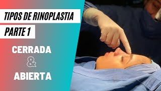 Tipos de Rinoplastia Parte 1 Rinoplastia Cerrada y Abierta [upl. by Park]