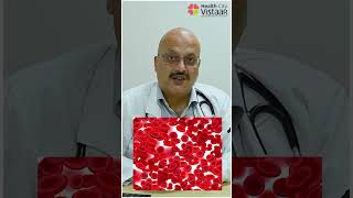 Dengue में PLATELET TRANSFUSION कब कराएं  Dr K P Chandra [upl. by Edme]