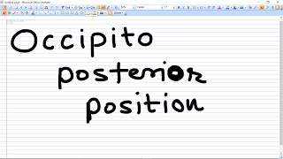 Occipito Posterior Position  types and Management [upl. by Ivetts962]