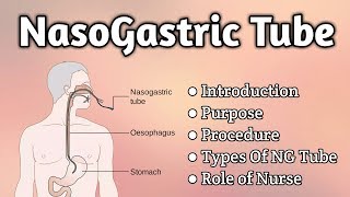 Nasogastric Tube Intubation [upl. by Light]