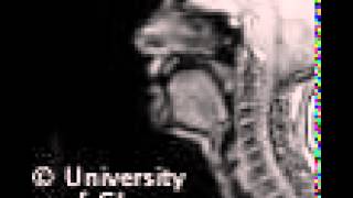 Voiceless uvular fricative MRI [upl. by Eitsyrc]