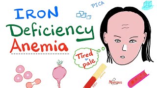 Iron Deficiency Anemia  All you need to know  Causes Symptoms Diagnosis Treatment [upl. by Alleen]