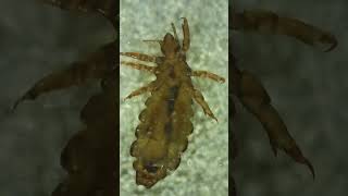 What Do Head Lice Really Look Like Under a Microscope [upl. by Swetlana]