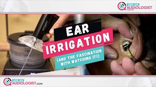 Ep 15 Ear Irrigation and the fascination with earwax removal videos [upl. by Adeehsar]