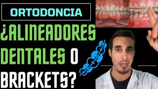 Ventajas y desventajas de ALINEADORES TRANSPARENTES y ORTODONCIA con BRACKETS [upl. by Joya]