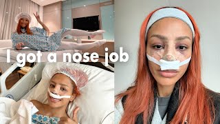 I got a NOSE JOB IN TURKEY What to expect surgery day bag prep pain cost why I did it pt 1 [upl. by Brita]