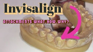 How to do bonding of invisalign clear Aligners attachments and buttons Clinical demo on Patients [upl. by Guillermo]