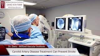 Carotid Artery Surgery New Haven CT For Stroke Prevention With The Best Vascular Surgeons in Milford [upl. by Willdon641]