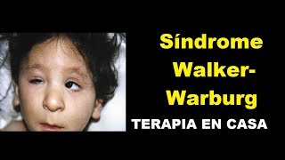 Sindrome walker warburg  Terapia en casa [upl. by Lesig]