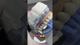 gc mc porselen kaplama dişhekimliğifakültesi dentist bracket veneers  ❤️🧿❤️🧿 [upl. by Ardnuasac578]