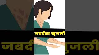 Say goodbye to itching Skin how to relieve itchy skin With Homeopathy [upl. by Dranyar809]