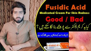 Fudic H Fusidic Acid Cream Uses  Side Effects  How to Use Fudic H Cream  Beauty Facts [upl. by Watson]