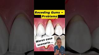 Why Receding Gums Are a Bigger Problem Than You Think dentallan dentist shorts [upl. by Anrak]