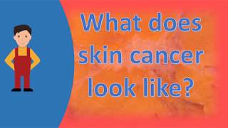 What does skin cancer look like  Best Health FAQS [upl. by Frederico]