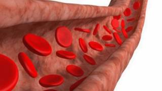 Difference Between Arteriosclerosis and Atherosclerosis [upl. by Araiek]