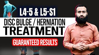 Get Rid Of L4 L5 And L5 S1 Disc Bulge With This Home Treatment  Guaranteed Results [upl. by Eerolam176]