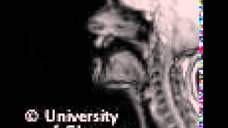 MRI voiceless retroflex plosive [upl. by Irat]