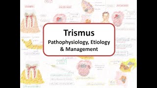 Trismus or Lockjaw Pathophysiology Etiology amp Management [upl. by Ethelred318]