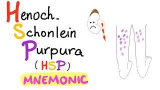 HenochSchönlein Purpura HSP  with a Mnemonic [upl. by Zetrac]