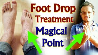 FOOT DROP Treatment By Acupressure  Single Acupressure Point For Foot Drop  In Hindi [upl. by Beane736]