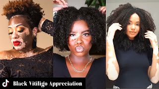 Black Vitiligo Appreciation Compilation  Black Girl TikTok [upl. by Er]