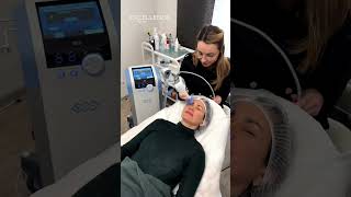 BTL Exilis Elite  Neinvazivní Omlazení Pleti [upl. by Animlehliw]