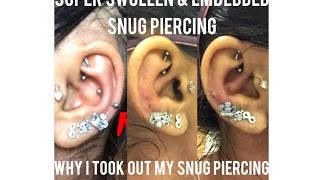 Super Swollen amp Embedded Snug Piercing  Why I Took Out My Snug Piercing [upl. by Ovid615]