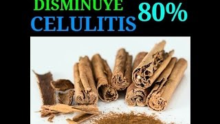 ACEITE MASERADO PARA COMBATIR LA CELULITIS [upl. by Esmerolda]