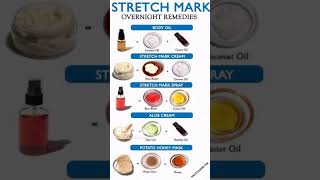 Stretch mark overnight remedies  simple and healthy tips [upl. by Stralka]