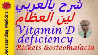 Vitamin D  deficiency Rickets and Osteomalacia شرح بالعربي نقص فيتامين د ولين العظام [upl. by Holle]