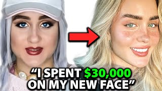 I was UGLY Before Spending 30000 on a NEW FACE  Surgeon Reacts [upl. by Flss553]