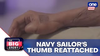 TBS  PH Navy seamans thumb reattached through medical procedure [upl. by Flinn885]