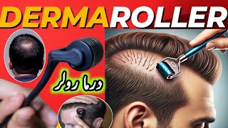 Microneedling  Derma Rolling for Hair Regrowth  Derma Roller Side Effects [upl. by Schilling]