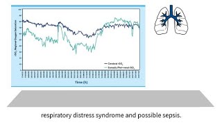 INVOS™ oximetry in the NICU Byte 10 NIRS to detect the hemodynamic impact of mechanical ventilation [upl. by Dichy]