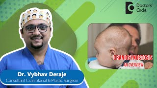 CRANIOSYNOSTOSIS Diagnosis amp Treatment children plasticsurgery DrVybhav Deraje Doctors Circle [upl. by Stauffer]