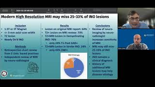 Internuclear Ophthalmoplegia INO on MRI [upl. by Mariel]