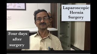 Laparoscopic Inguinal Hernia surgery Patient recovery on day 4 after surgery [upl. by Kho247]