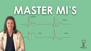 NSTEMI vs STEMI Differentiating Myocardial Infarctions [upl. by Nikolai]