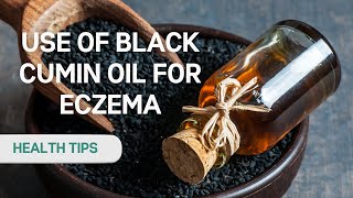 Want to Say Goodbye to Eczema Watch This Black Seed Oil Video Now [upl. by Joab]