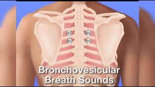 BRONCHOVESICULAR LUNG SOUND [upl. by Ahsenot761]