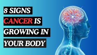 8 ALARMING SIGNS CANCER IS GROWING IN YOU [upl. by Allyn]