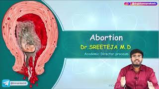 Abortion  Part 1   Obstetrics and Gynaecology Lecture [upl. by Emelun293]