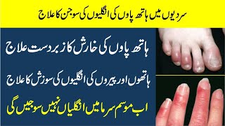 Hathon or paon ki ungliyon Ki Sojan Ka ilaj  Fingers swelling in winter  chilblain treatment urdu [upl. by Amity325]