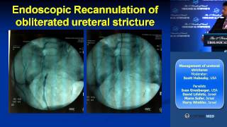 Panel Management of ureteral strictures [upl. by Vallonia973]