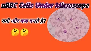 How to make nRBC  Nucleated cells on slide  nRBC under microscope [upl. by Fadden662]