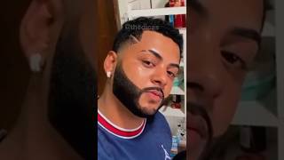 5 MESES usando MINOXIDIL resultado com minoxidil barba minoxidil barbudo [upl. by Nollid422]