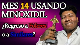 MES 14 USANDO MINOXIDIL KIRKLAND [upl. by Nehemiah]