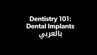 Basics of Dental Implants بالعربي [upl. by Ssirk]