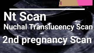 nt scan nt scan in 3 months pregnant nuchal translucency ultrasound 12 weeks [upl. by Dahlstrom]