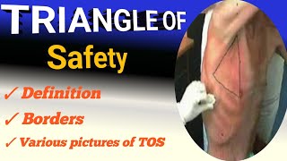 triangle of safety  definition  boundaries [upl. by Ecinhoj]